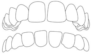 dentist_gapped