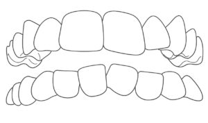 dentist_overcrowded